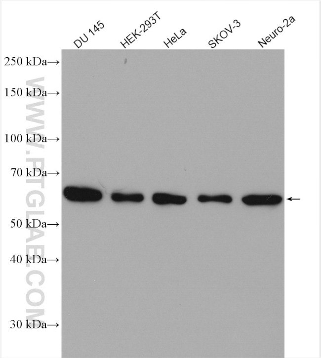 USP14 Antibody in Western Blot (WB)