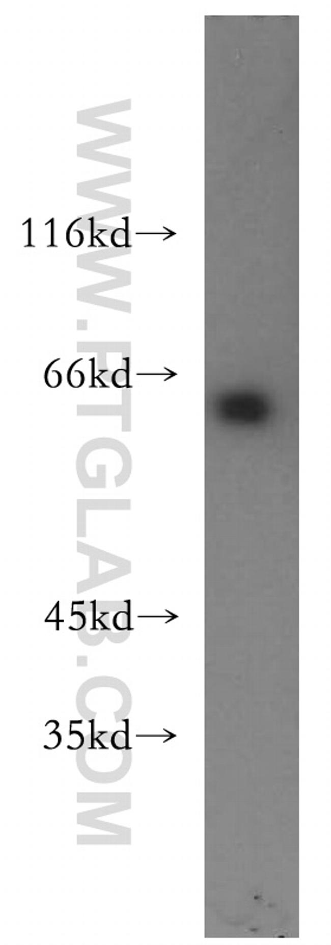 USP14 Antibody in Western Blot (WB)