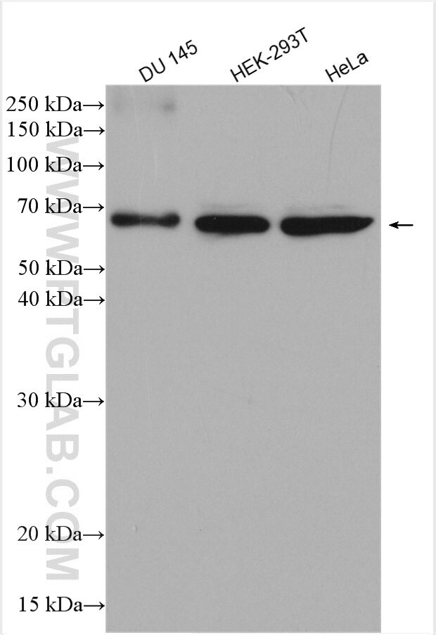 USP14 Antibody in Western Blot (WB)