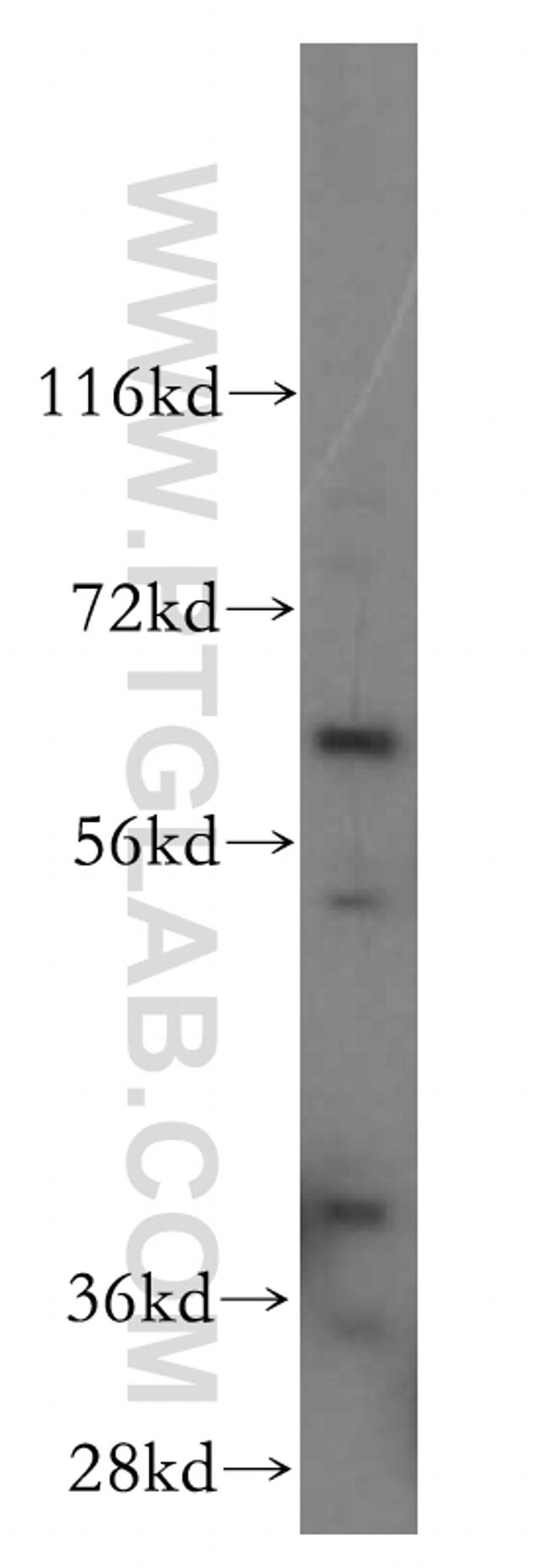 USP14 Antibody in Western Blot (WB)