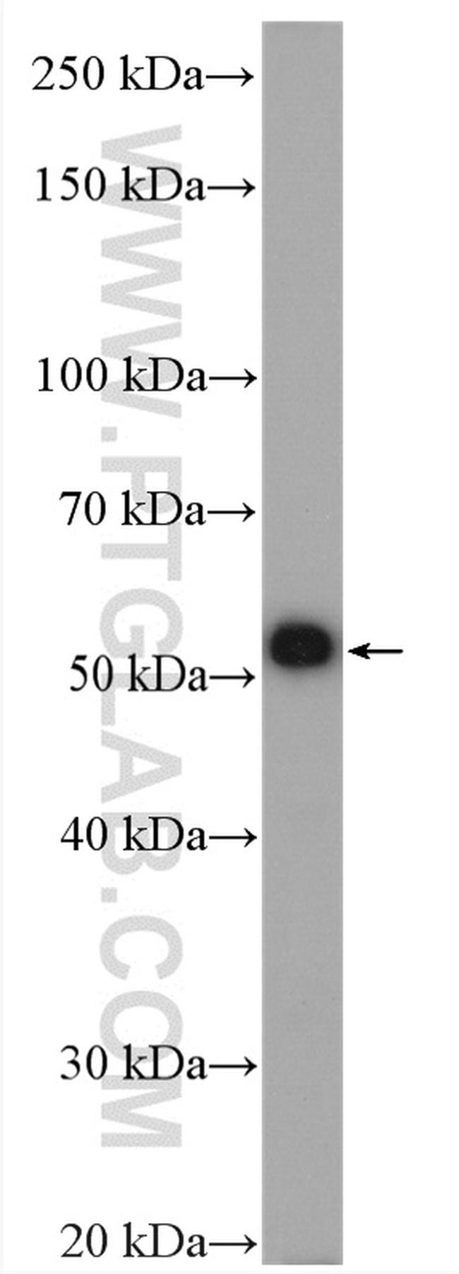 USP14 Antibody in Western Blot (WB)