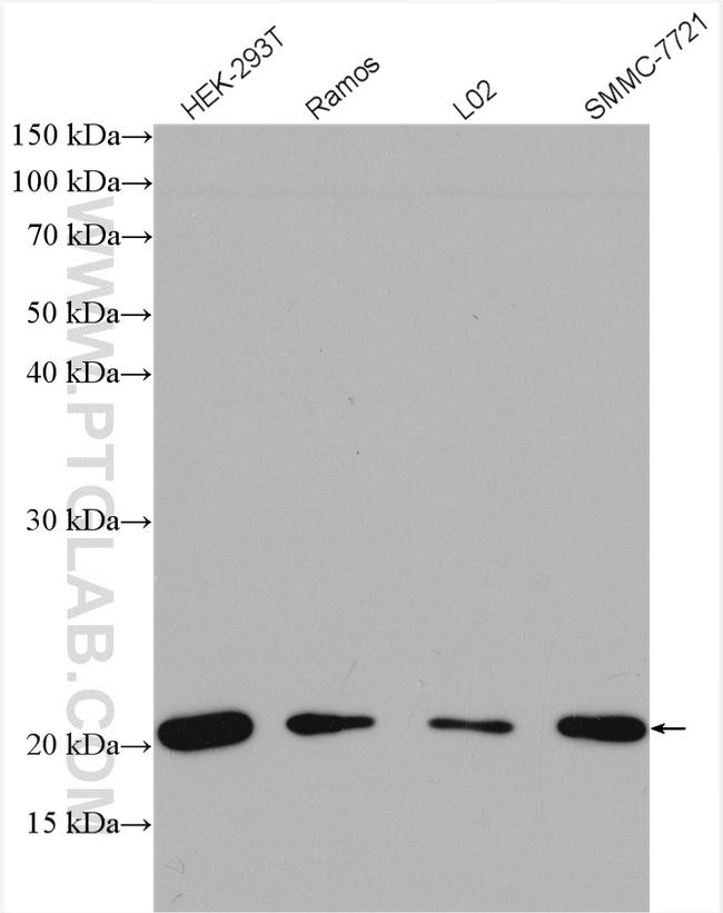 UBC12 Antibody in Western Blot (WB)