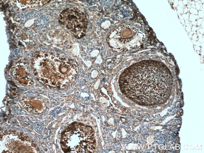 UBC12 Antibody in Immunohistochemistry (Paraffin) (IHC (P))