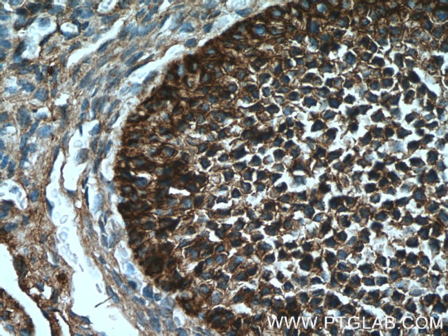 UBC12 Antibody in Immunohistochemistry (Paraffin) (IHC (P))