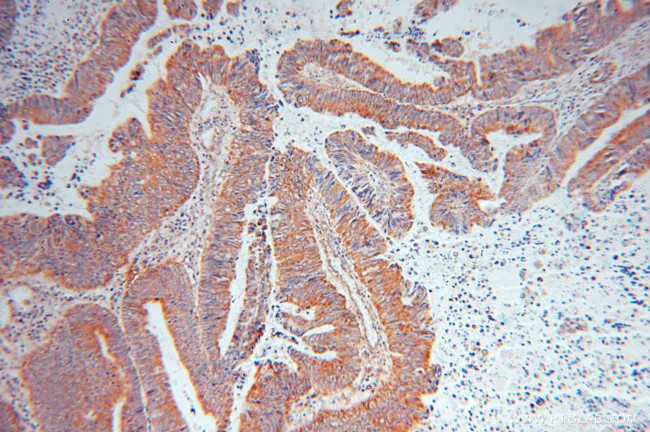 CRMP2 Antibody in Immunohistochemistry (Paraffin) (IHC (P))