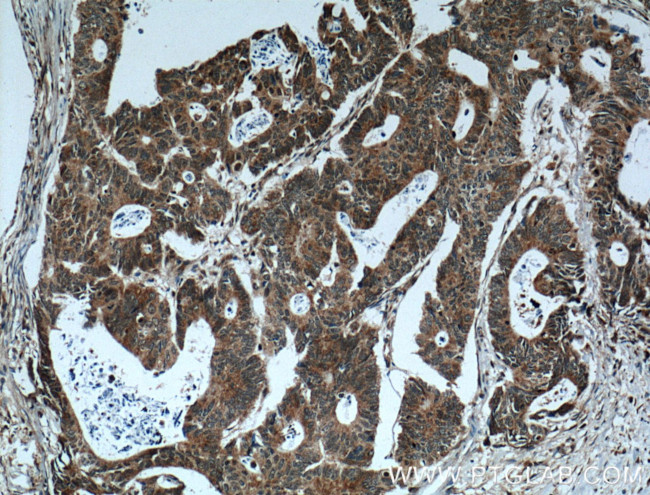 CRMP2 Antibody in Immunohistochemistry (Paraffin) (IHC (P))