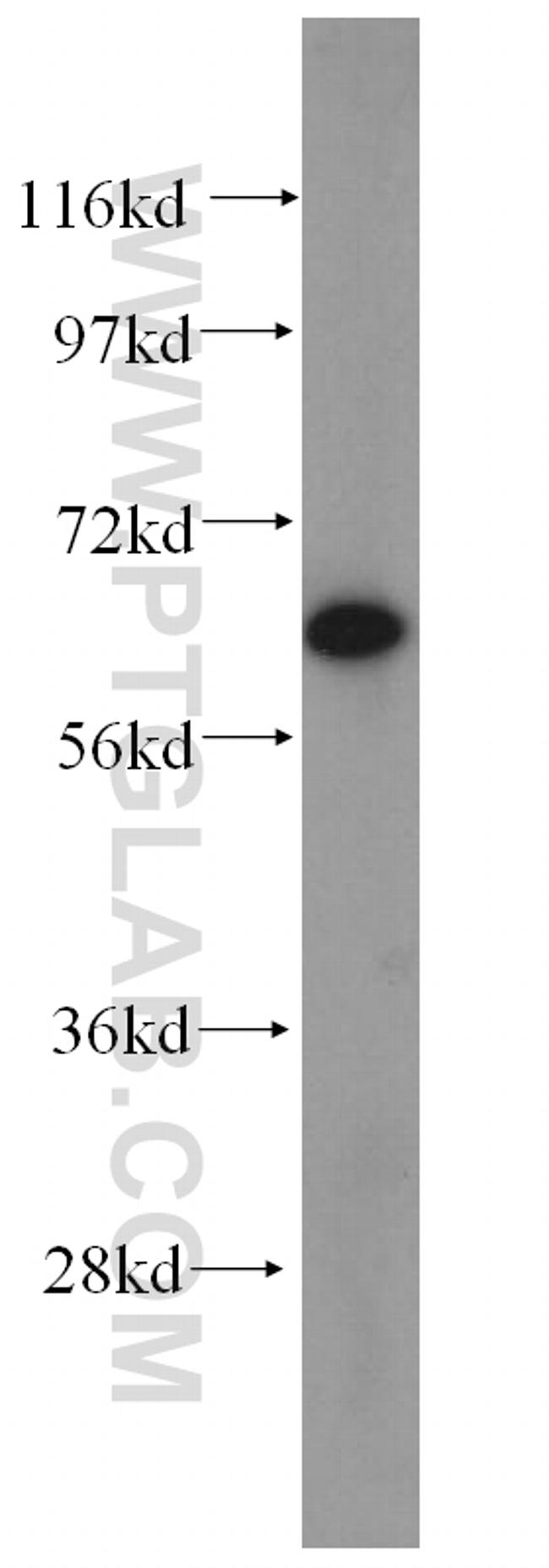 CRMP2 Antibody in Western Blot (WB)