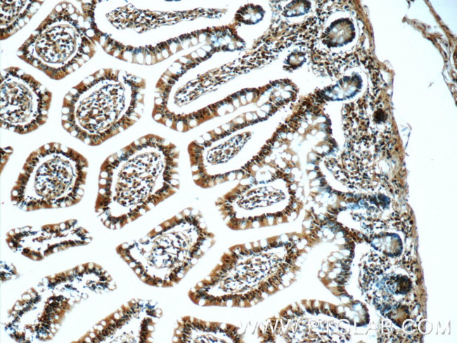 hnRNP-E1 Antibody in Immunohistochemistry (Paraffin) (IHC (P))