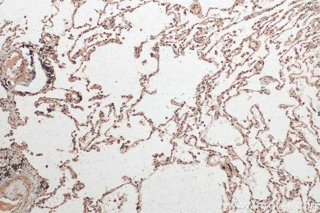 hnRNP-E1 Antibody in Immunohistochemistry (Paraffin) (IHC (P))