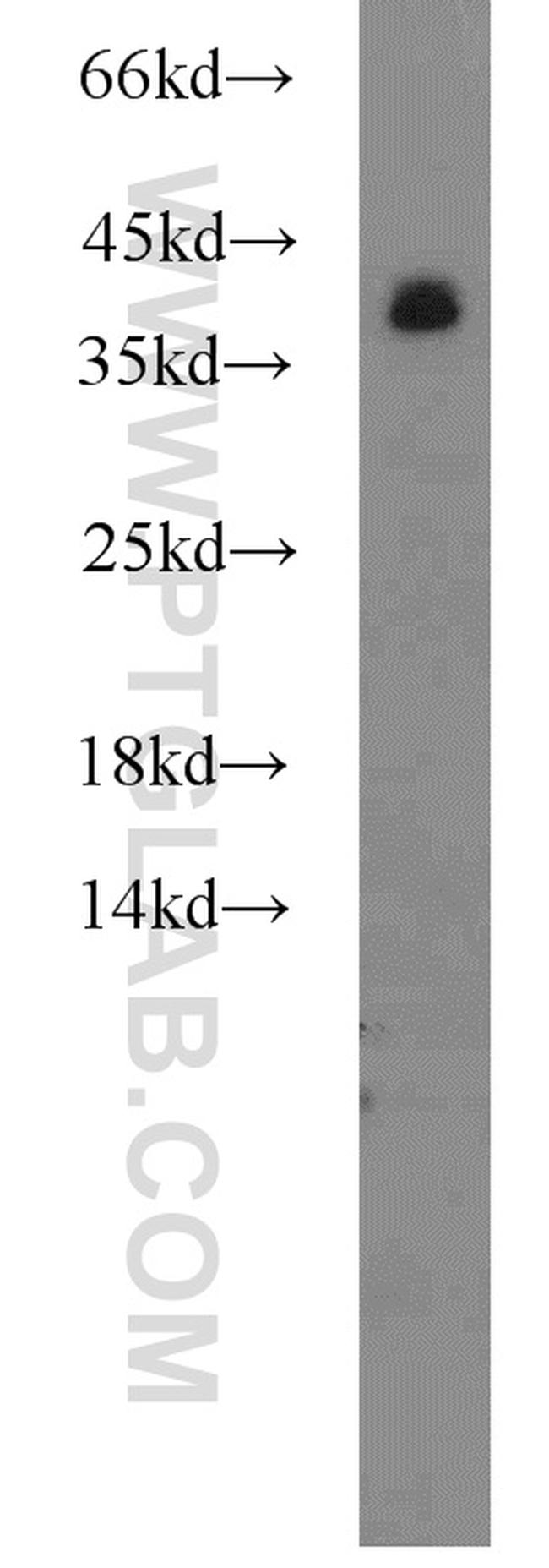 hnRNP-E1 Antibody in Western Blot (WB)