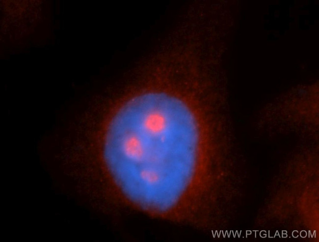 MYBBP1A Antibody in Immunocytochemistry (ICC/IF)