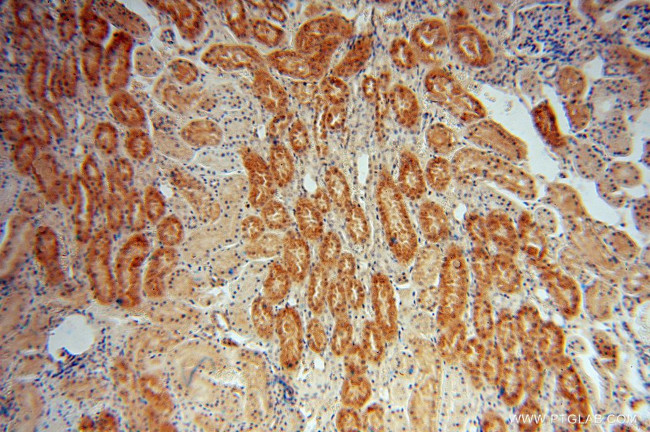 MYBBP1A Antibody in Immunohistochemistry (Paraffin) (IHC (P))