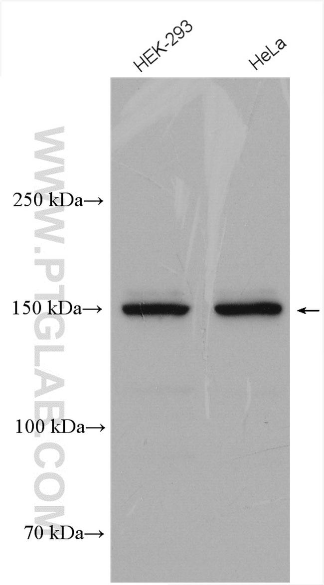 MYBBP1A Antibody in Western Blot (WB)