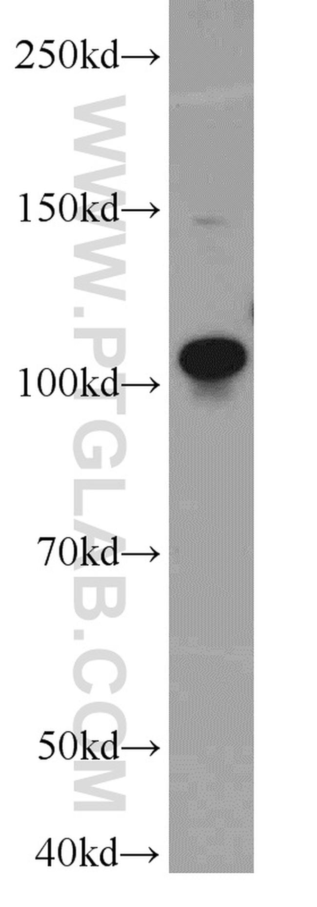 TOP3A Antibody in Western Blot (WB)