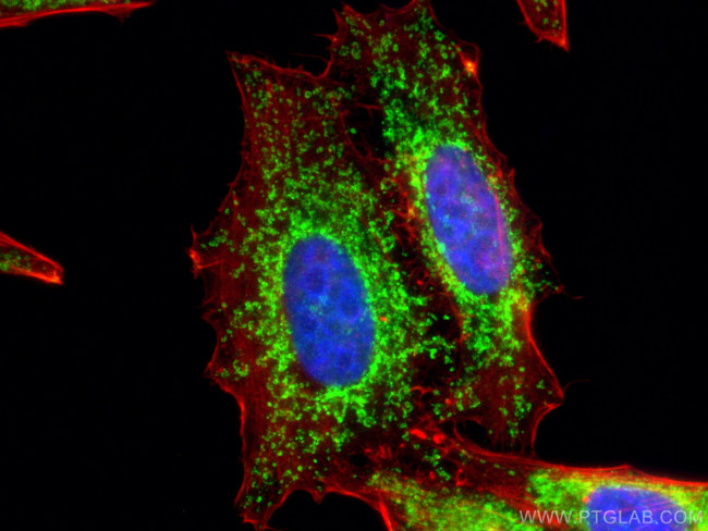 TOM70 Antibody in Immunocytochemistry (ICC/IF)