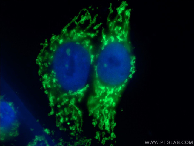 TOM70 Antibody in Immunocytochemistry (ICC/IF)