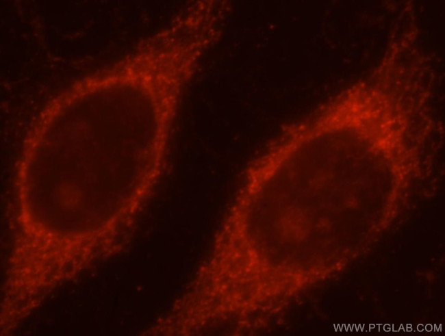 TOM70 Antibody in Immunocytochemistry (ICC/IF)