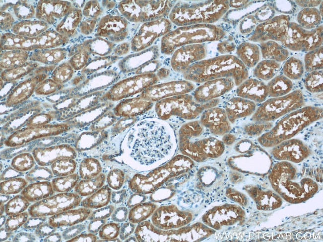 TOM70 Antibody in Immunohistochemistry (Paraffin) (IHC (P))