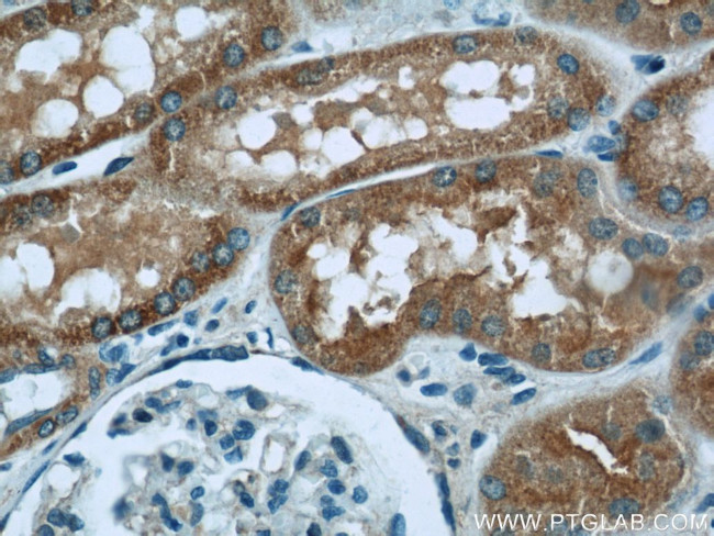 TOM70 Antibody in Immunohistochemistry (Paraffin) (IHC (P))