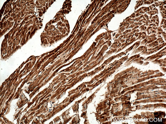 TOM70 Antibody in Immunohistochemistry (Paraffin) (IHC (P))