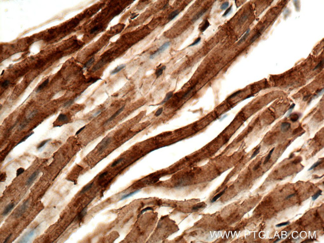 TOM70 Antibody in Immunohistochemistry (Paraffin) (IHC (P))