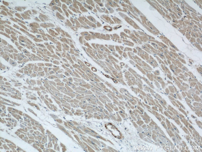 TOM70 Antibody in Immunohistochemistry (Paraffin) (IHC (P))