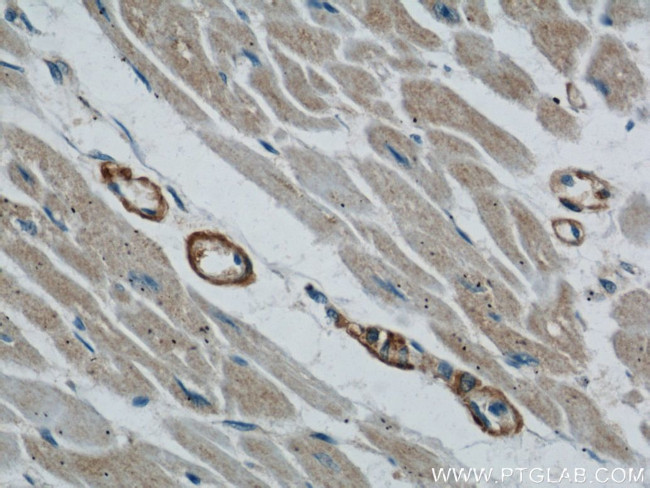 TOM70 Antibody in Immunohistochemistry (Paraffin) (IHC (P))