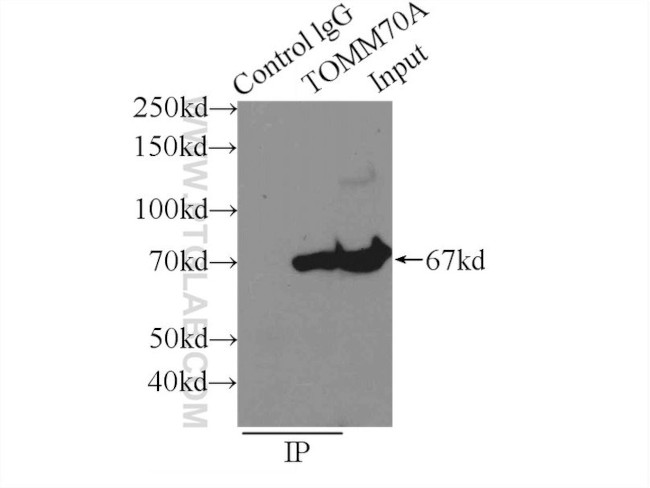 TOM70 Antibody in Immunoprecipitation (IP)