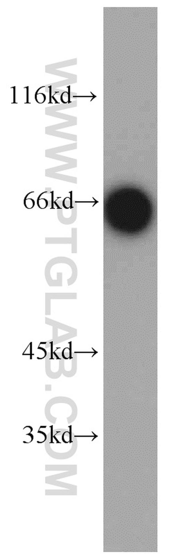 TOM70 Antibody in Western Blot (WB)