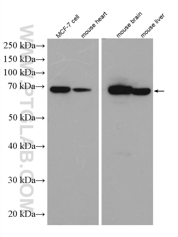 TOM70 Antibody in Western Blot (WB)