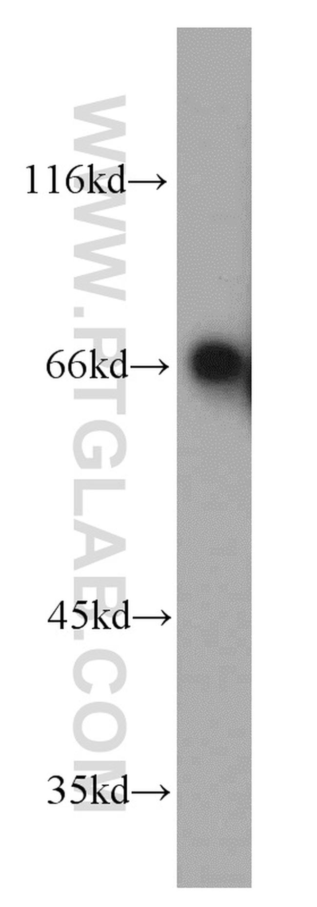 TOM70 Antibody in Western Blot (WB)