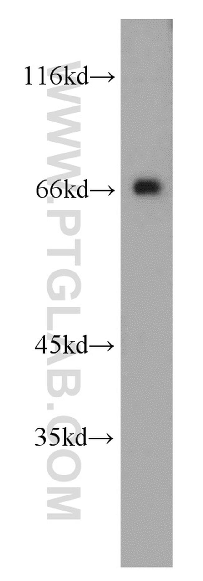 TOM70 Antibody in Western Blot (WB)