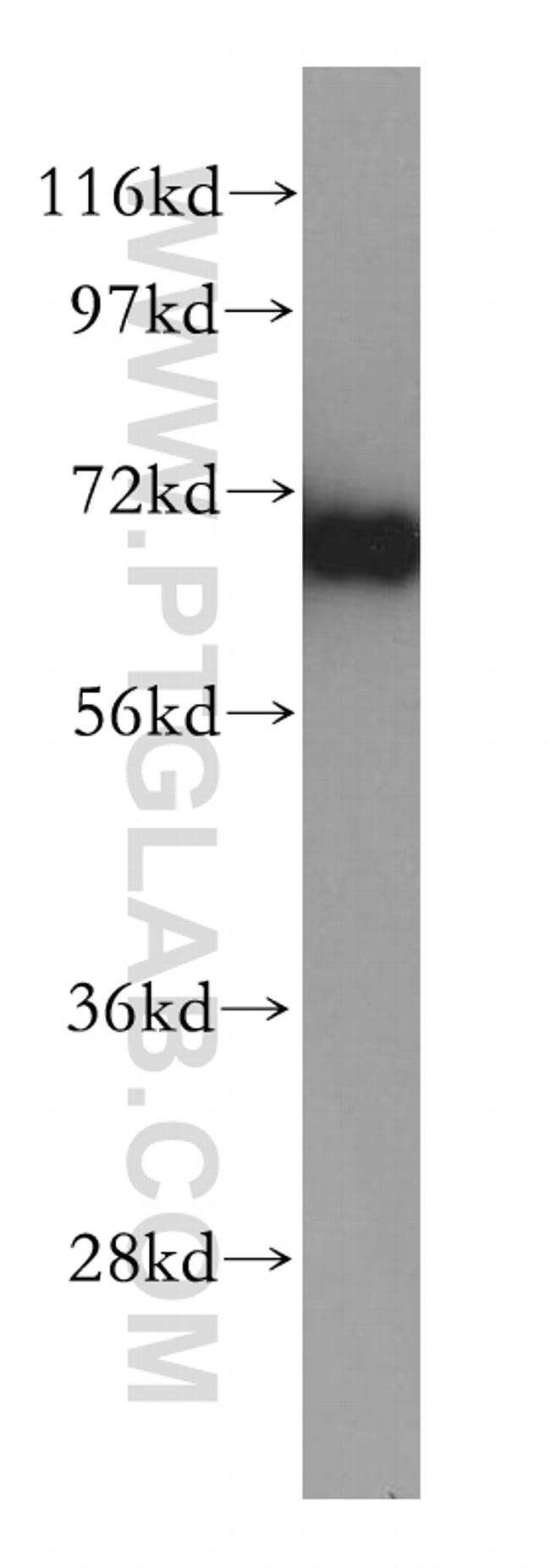 TOM70 Antibody in Western Blot (WB)