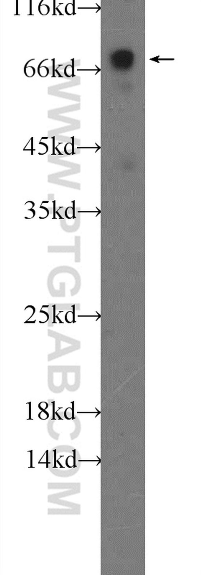 TOM70 Antibody in Western Blot (WB)