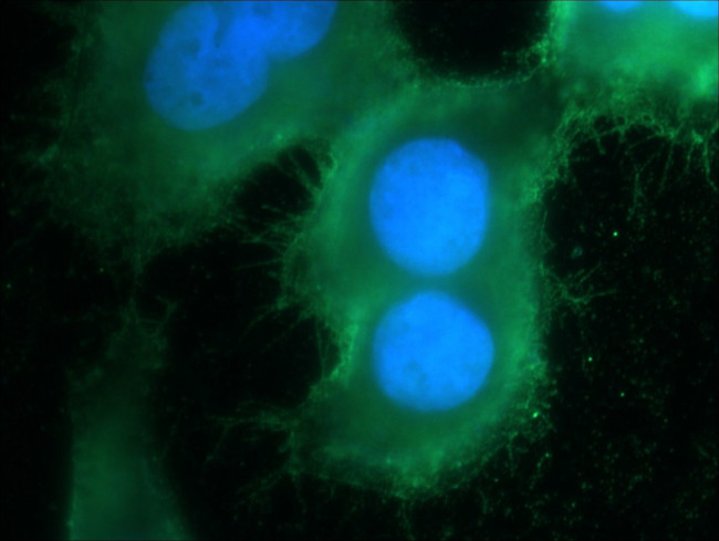 RGS4 Antibody in Immunocytochemistry (ICC/IF)