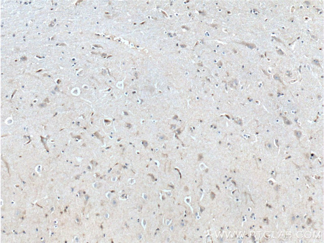 RGS4 Antibody in Immunohistochemistry (Paraffin) (IHC (P))