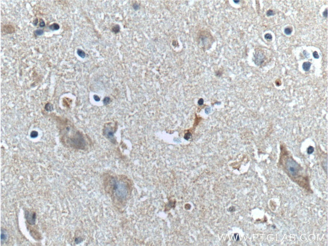 RGS4 Antibody in Immunohistochemistry (Paraffin) (IHC (P))