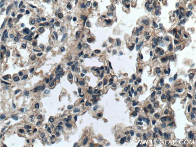 RGS4 Antibody in Immunohistochemistry (Paraffin) (IHC (P))