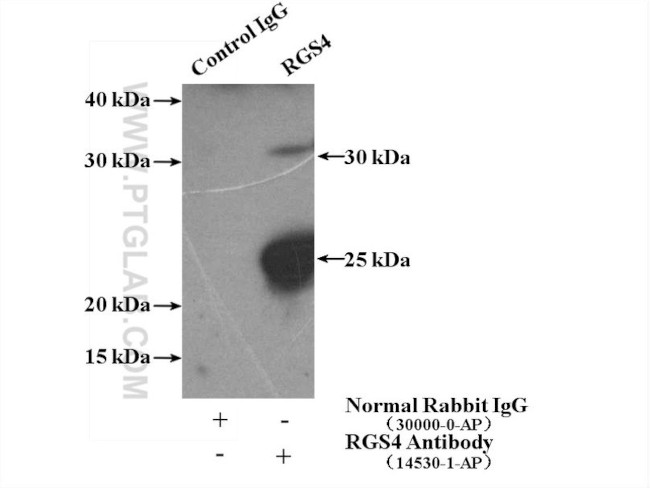 RGS4 Antibody in Immunoprecipitation (IP)