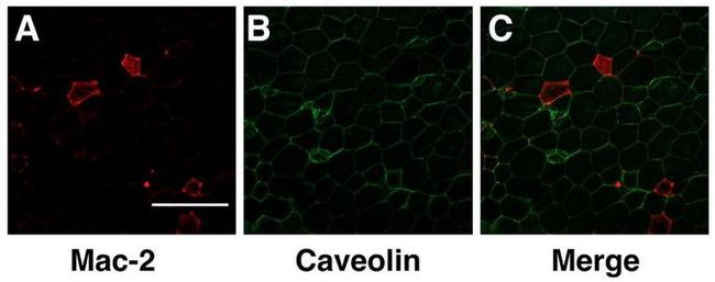 Galectin 3 Antibody in Immunohistochemistry (IHC)