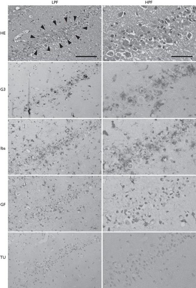 Galectin 3 Antibody in Immunohistochemistry (IHC)