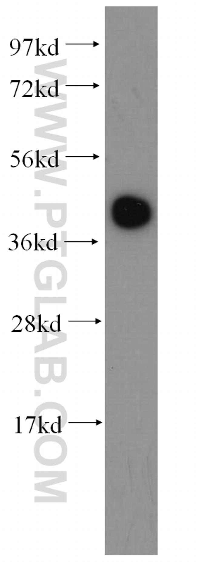 LAMR1/RPSA Antibody in Western Blot (WB)