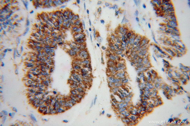 GSTK1 Antibody in Immunohistochemistry (Paraffin) (IHC (P))