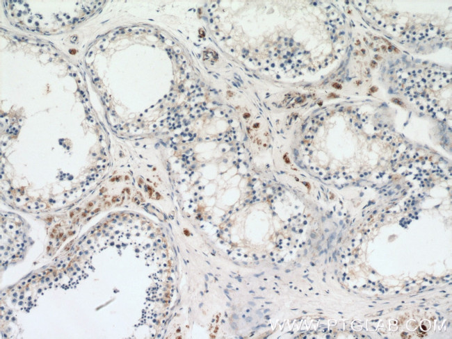 GSTK1 Antibody in Immunohistochemistry (Paraffin) (IHC (P))