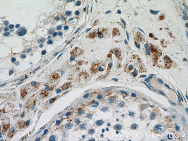 GSTK1 Antibody in Immunohistochemistry (Paraffin) (IHC (P))