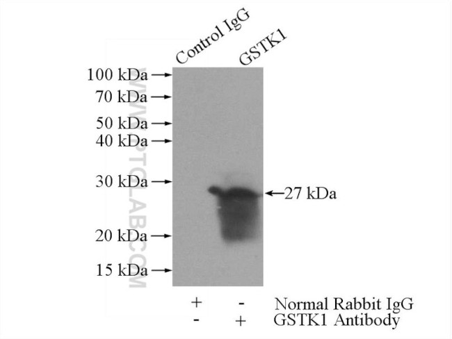 GSTK1 Antibody in Immunoprecipitation (IP)