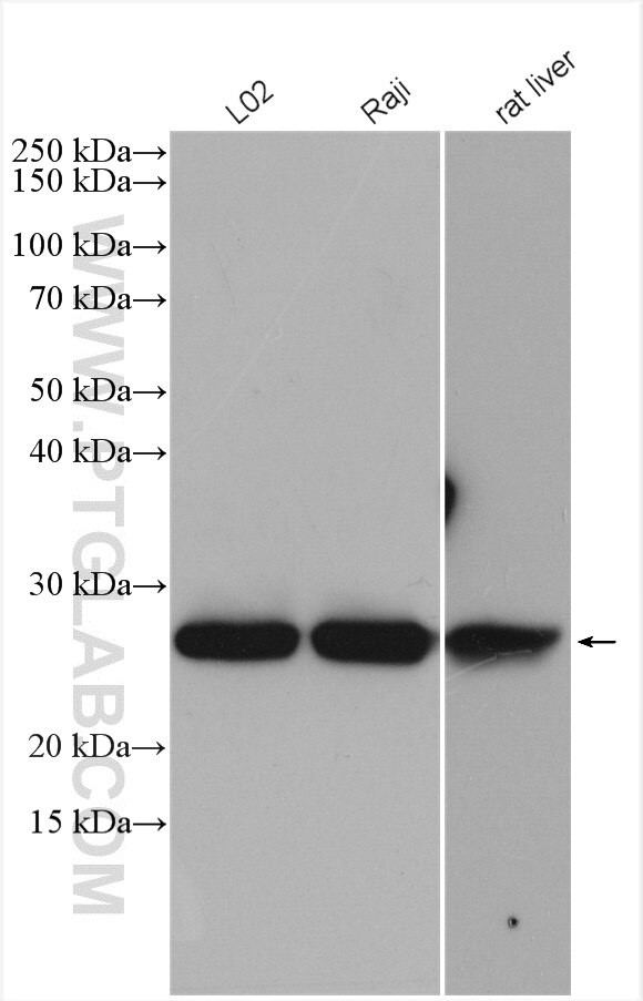 GSTK1 Antibody in Western Blot (WB)