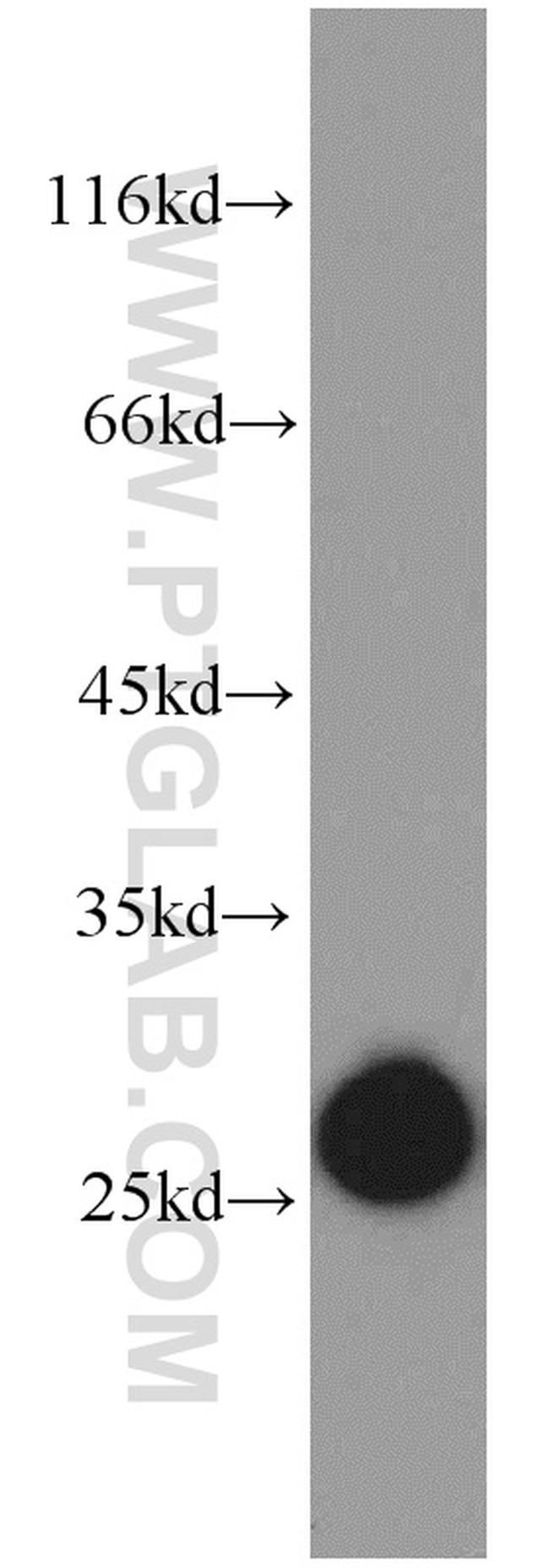 GSTK1 Antibody in Western Blot (WB)