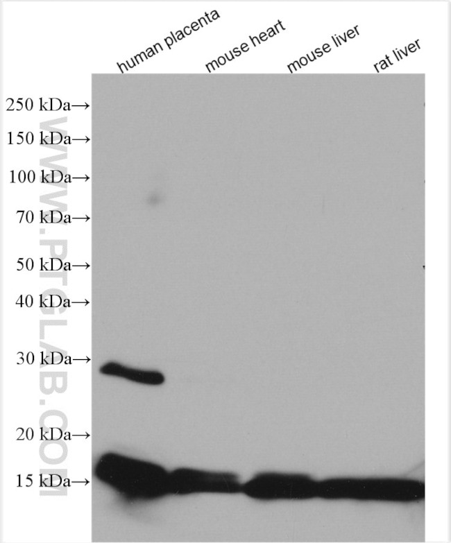 Hemoglobin alpha Antibody in Western Blot (WB)