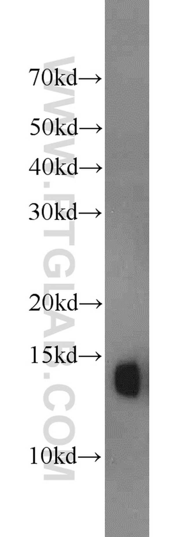 Hemoglobin alpha Antibody in Western Blot (WB)